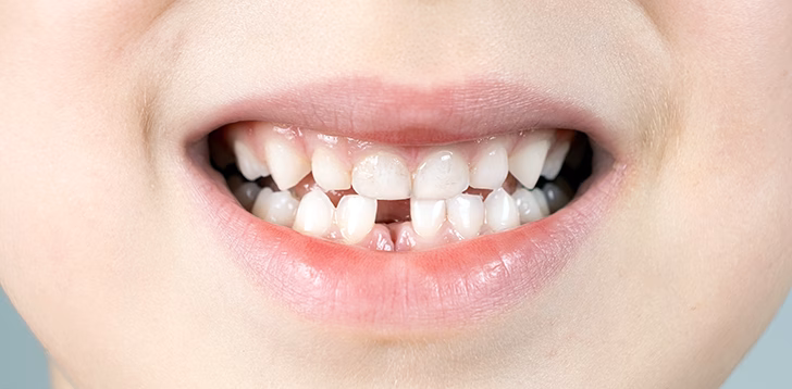 Gigi Copot di Usia Tua Bisa Jadi Tanda Umur Pendek, Ini Penjelasan Ilmiahnya 1 gigi copot usia tua